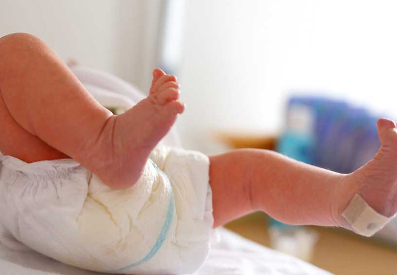 baby-boy-after-birth-with-hypospadias-Dr.-Antoine-Khoury