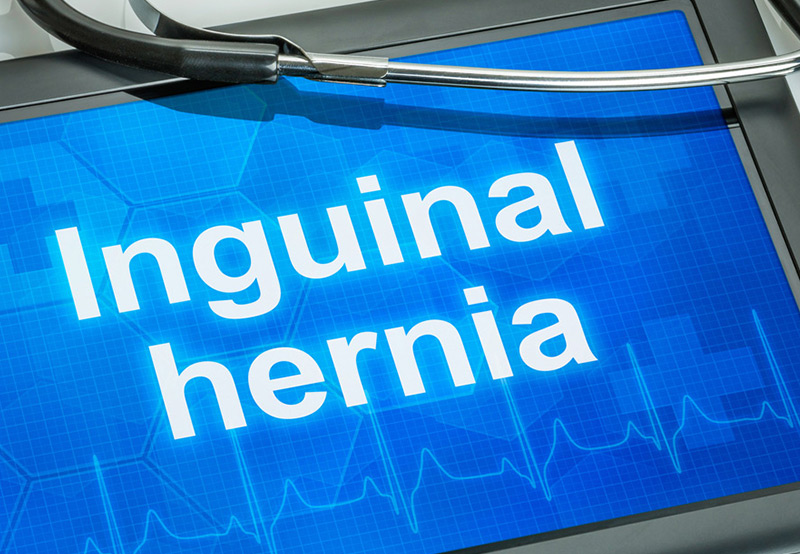 medical-concept-of-inguinal-hernia-Dr.-Antoine-Khoury
