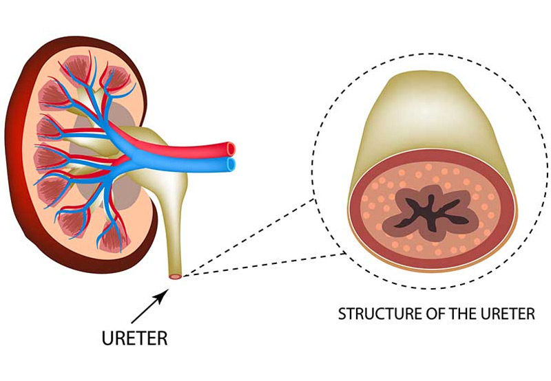 typical-structure-of-the-ureter-as-opposed-to-ureteral-duplication-Dr.-Antoine-Khoury